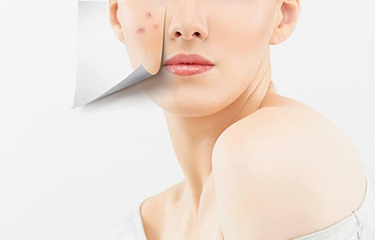 祛痘化妝品效果怎么樣?什么方法祛痘效果更好?