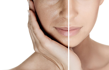 減緩衰老儀器設備常用的有哪些？哪個品牌性價比較高？